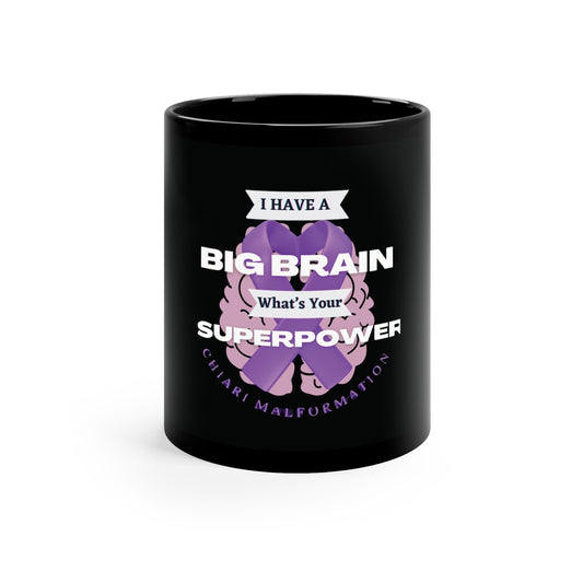 Big Brain whats your Superpower Custom Mug